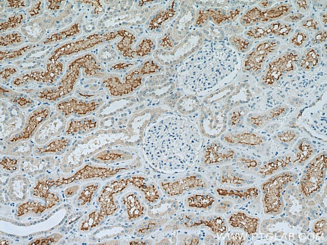 ACE2 Antibody in Immunohistochemistry (Paraffin) (IHC (P))