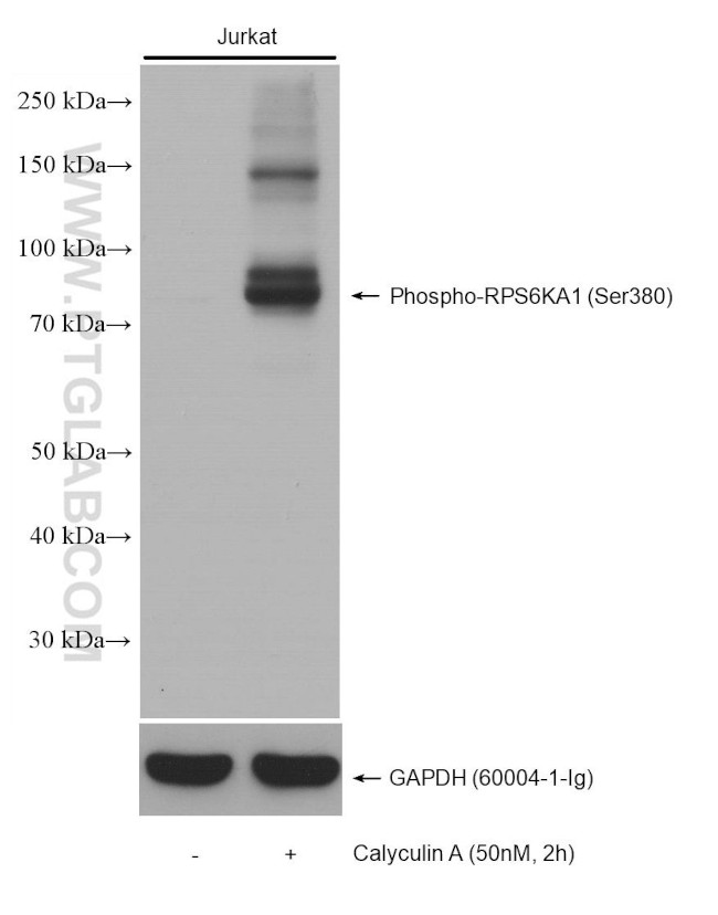 Phospho-RPS6KA1 (Ser380) Antibody in Western Blot (WB)