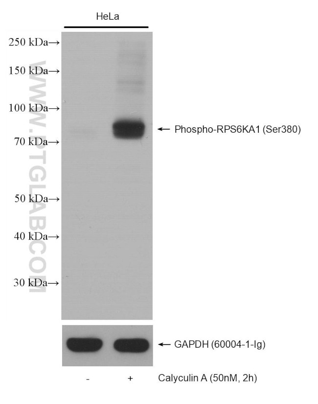 Phospho-RPS6KA1 (Ser380) Antibody in Western Blot (WB)