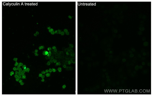 Phospho-STK11 (Thr189) Antibody in Immunocytochemistry (ICC/IF)