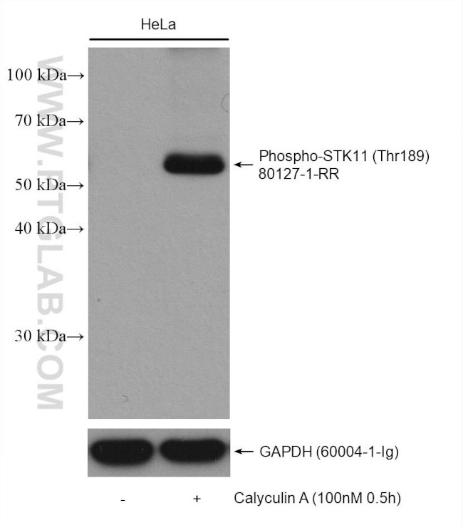 Phospho-STK11 (Thr189) Antibody in Western Blot (WB)