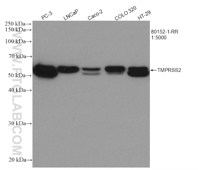 TMPRSS2 Antibody in Western Blot (WB)