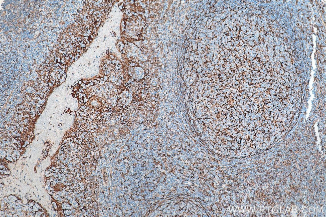 TMEM173/STING Antibody in Immunohistochemistry (Paraffin) (IHC (P))