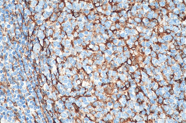 TMEM173/STING Antibody in Immunohistochemistry (Paraffin) (IHC (P))