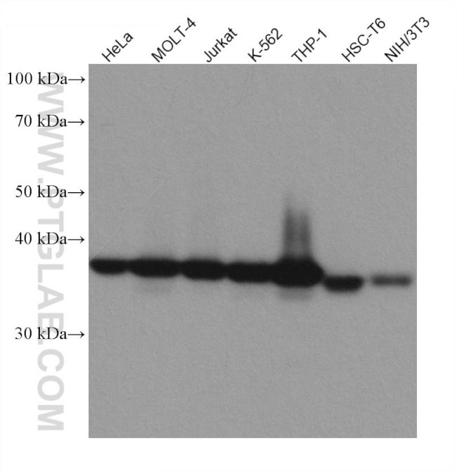 TMEM173/STING Antibody in Western Blot (WB)