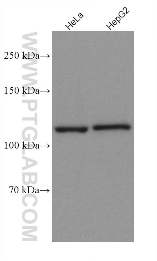 PARP1 Antibody in Western Blot (WB)