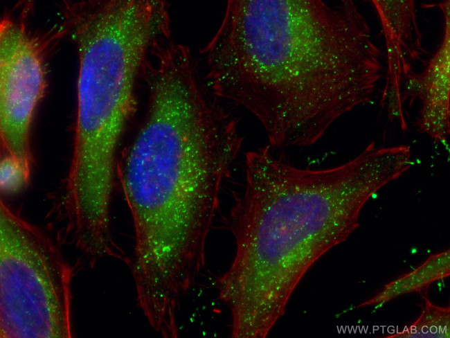 PEX14 Antibody in Immunocytochemistry (ICC/IF)