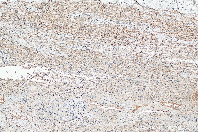 PEX14 Antibody in Immunohistochemistry (Paraffin) (IHC (P))