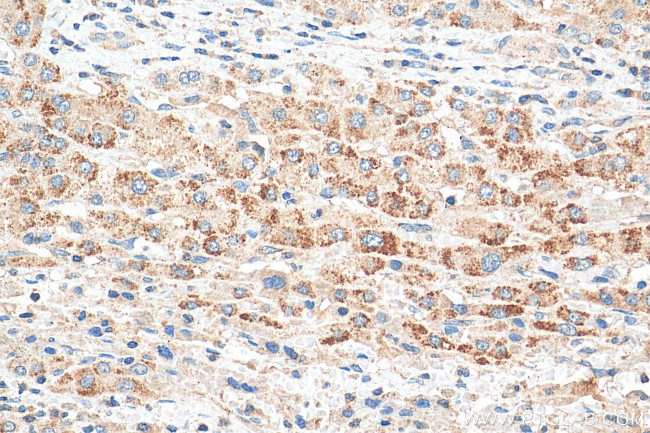 PEX14 Antibody in Immunohistochemistry (Paraffin) (IHC (P))