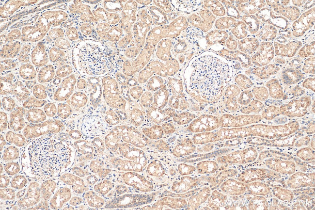 PEX14 Antibody in Immunohistochemistry (Paraffin) (IHC (P))