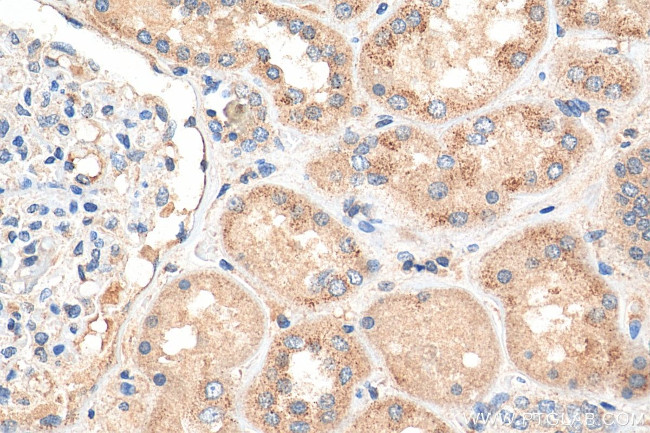 PEX14 Antibody in Immunohistochemistry (Paraffin) (IHC (P))