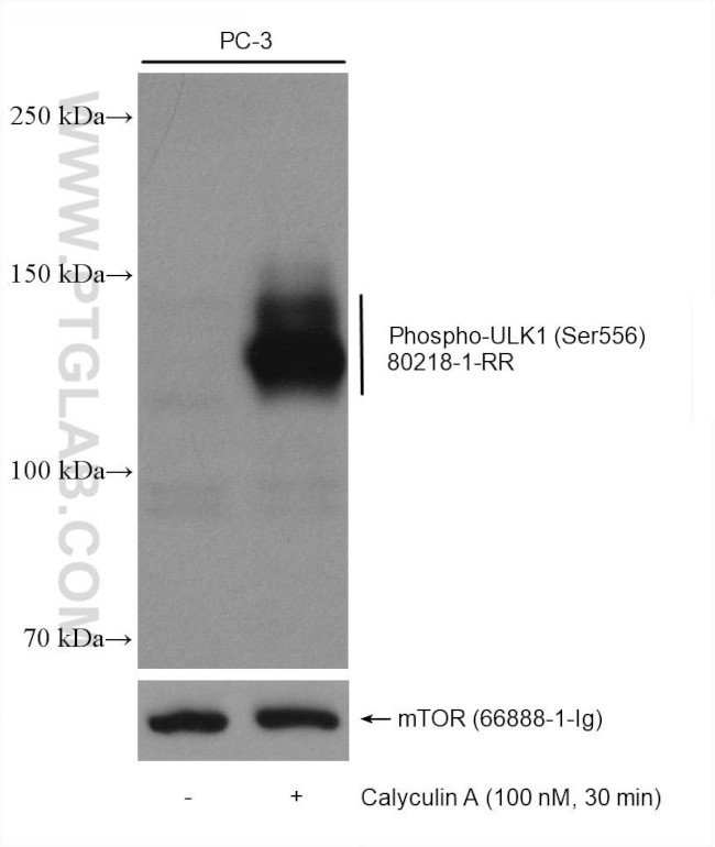 Phospho-ULK1 (Ser556) Antibody in Western Blot (WB)