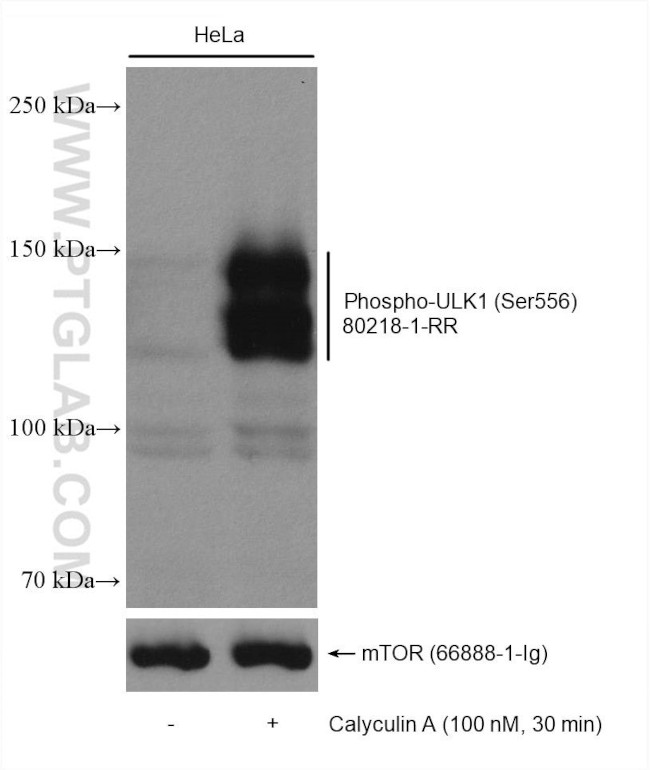 Phospho-ULK1 (Ser556) Antibody in Western Blot (WB)