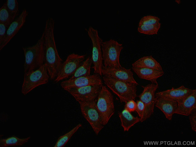 H3K9me1/2 Antibody in Immunocytochemistry (ICC/IF)