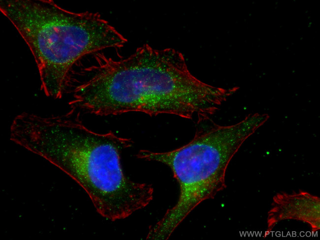 PEX14 Antibody in Immunocytochemistry (ICC/IF)