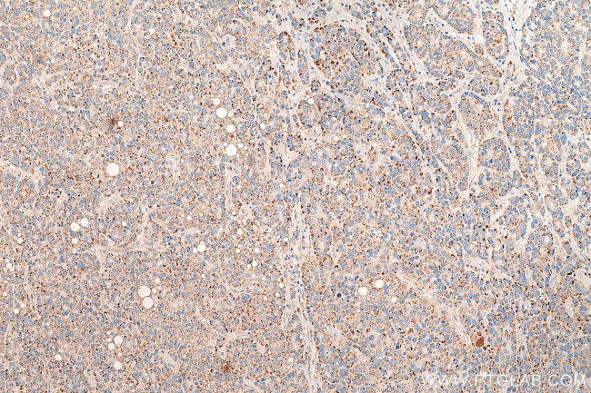 PEX14 Antibody in Immunohistochemistry (Paraffin) (IHC (P))