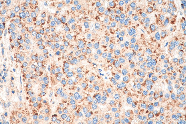 PEX14 Antibody in Immunohistochemistry (Paraffin) (IHC (P))