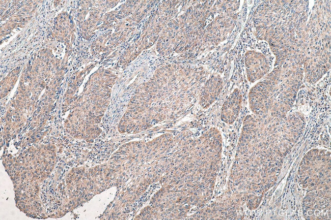 PEX14 Antibody in Immunohistochemistry (Paraffin) (IHC (P))