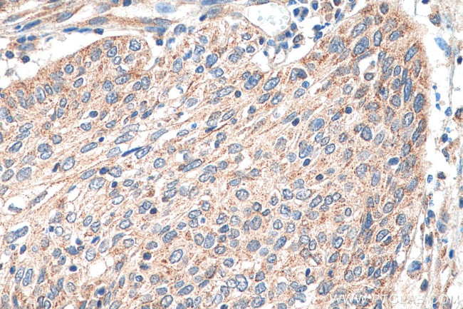 PEX14 Antibody in Immunohistochemistry (Paraffin) (IHC (P))