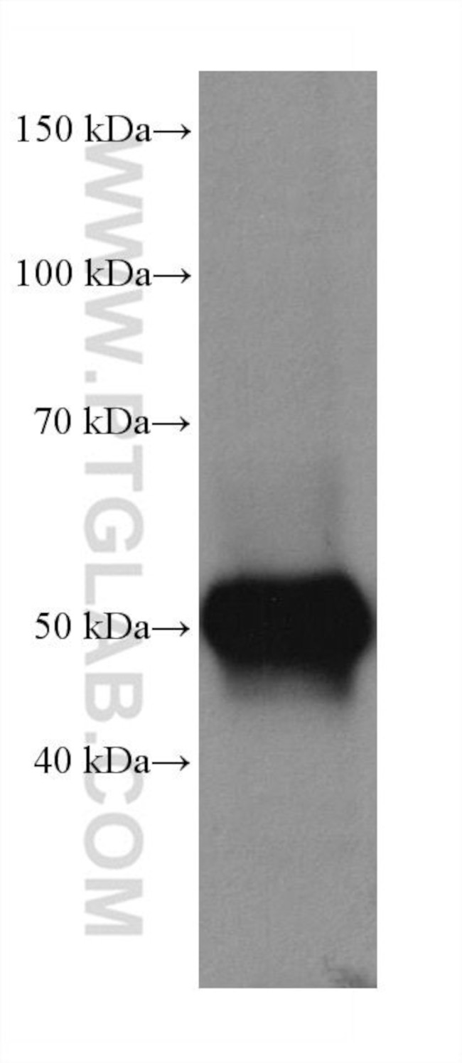 TTYH1 Antibody in Western Blot (WB)