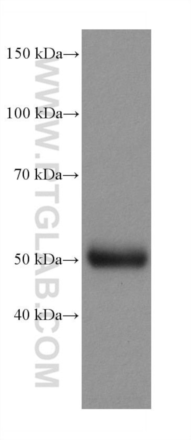 TTYH1 Antibody in Western Blot (WB)