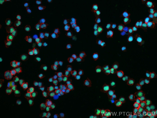 METTL3 Antibody in Immunocytochemistry (ICC/IF)