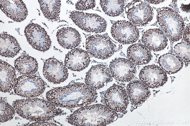 METTL3 Antibody in Immunohistochemistry (Paraffin) (IHC (P))