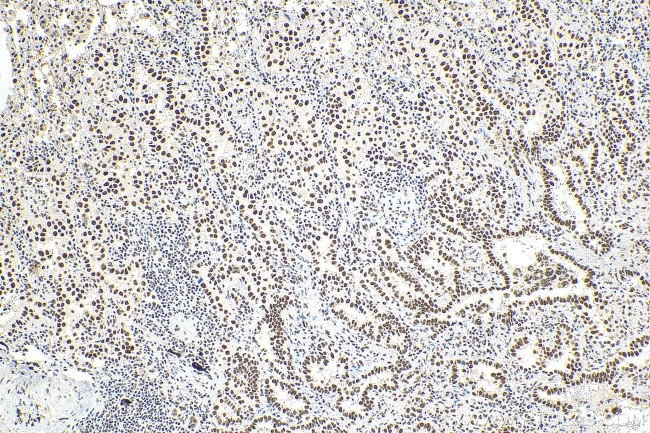 METTL3 Antibody in Immunohistochemistry (Paraffin) (IHC (P))