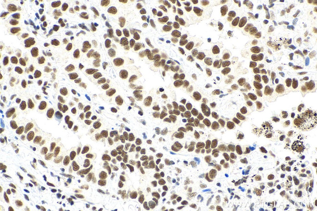 METTL3 Antibody in Immunohistochemistry (Paraffin) (IHC (P))