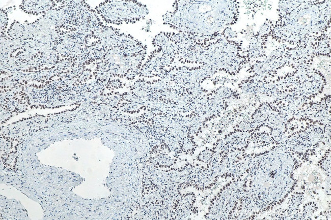 METTL3 Antibody in Immunohistochemistry (Paraffin) (IHC (P))