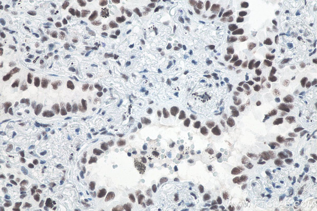 METTL3 Antibody in Immunohistochemistry (Paraffin) (IHC (P))