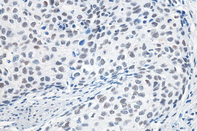 METTL3 Antibody in Immunohistochemistry (Paraffin) (IHC (P))