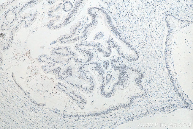 METTL3 Antibody in Immunohistochemistry (Paraffin) (IHC (P))