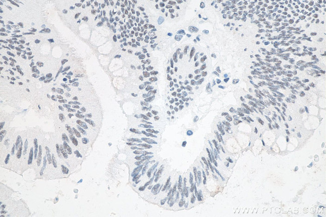 METTL3 Antibody in Immunohistochemistry (Paraffin) (IHC (P))