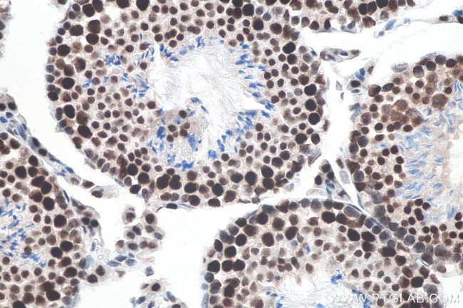 METTL3 Antibody in Immunohistochemistry (Paraffin) (IHC (P))