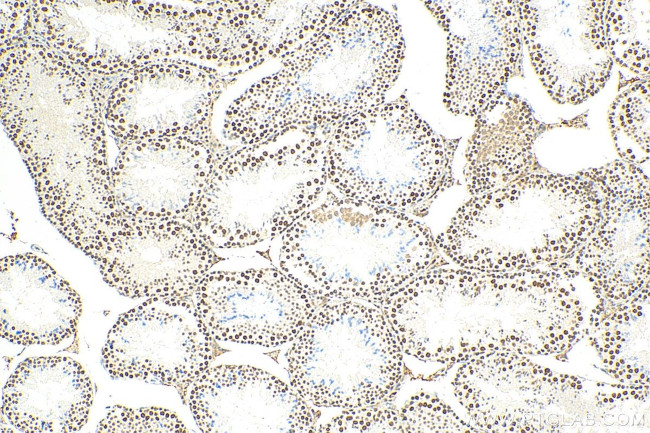 METTL3 Antibody in Immunohistochemistry (Paraffin) (IHC (P))