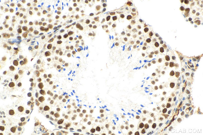 METTL3 Antibody in Immunohistochemistry (Paraffin) (IHC (P))