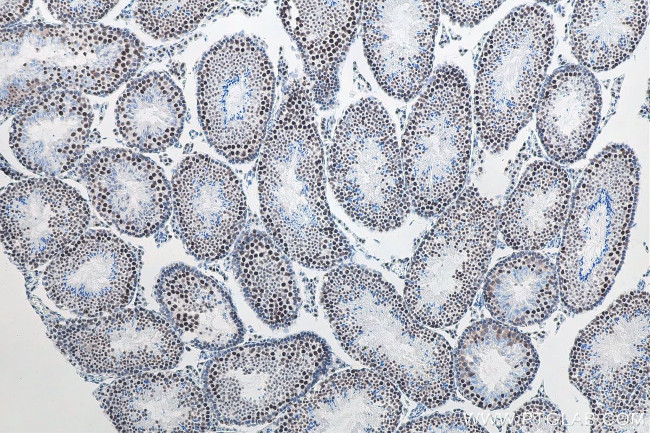 METTL3 Antibody in Immunohistochemistry (Paraffin) (IHC (P))