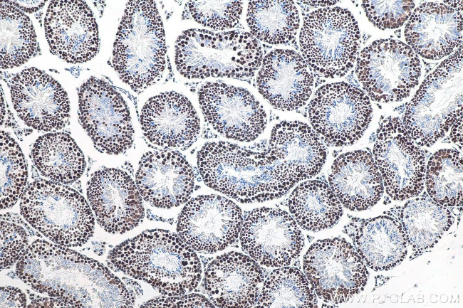 METTL3 Antibody in Immunohistochemistry (Paraffin) (IHC (P))