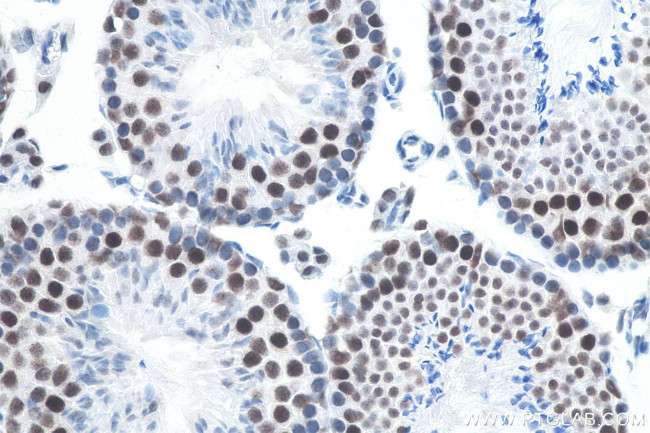 METTL3 Antibody in Immunohistochemistry (Paraffin) (IHC (P))