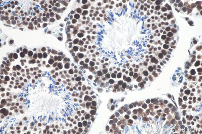 METTL3 Antibody in Immunohistochemistry (Paraffin) (IHC (P))