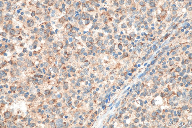 JAK3 Antibody in Immunohistochemistry (Paraffin) (IHC (P))