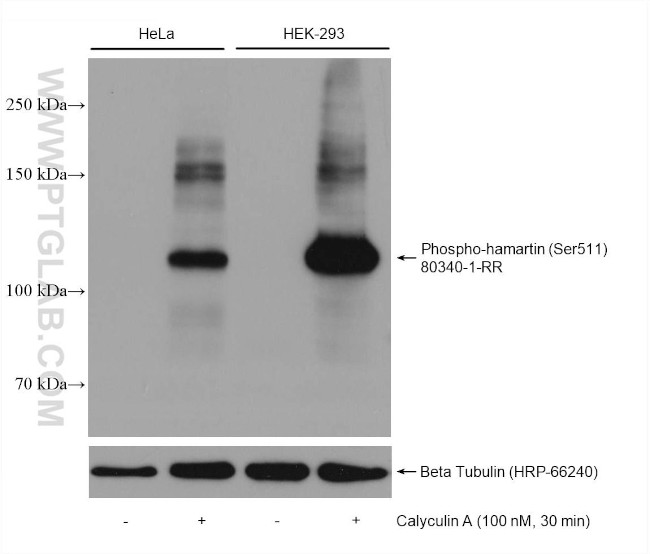 Phospho-Hamartin/TSC1 (Ser511) Antibody in Western Blot (WB)