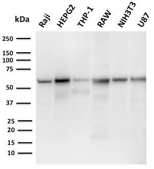 PD-L2/PDCD1LG2/CD273 Antibody in Western Blot (WB)