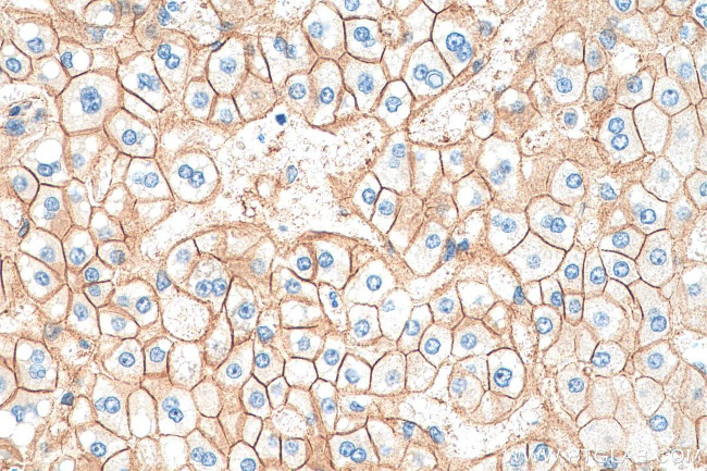 Beta Catenin Antibody in Immunohistochemistry (Paraffin) (IHC (P))