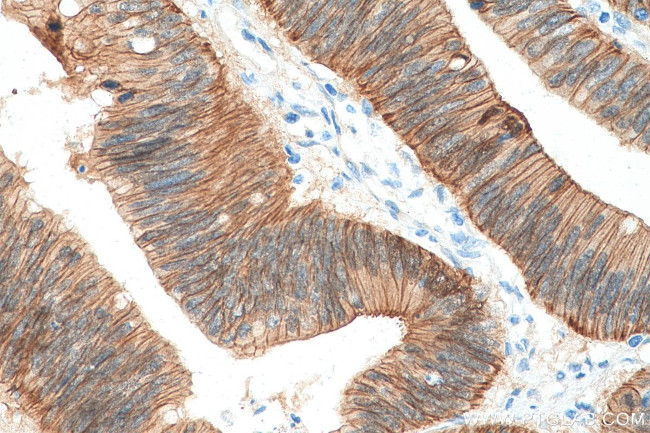 Beta Catenin Antibody in Immunohistochemistry (Paraffin) (IHC (P))