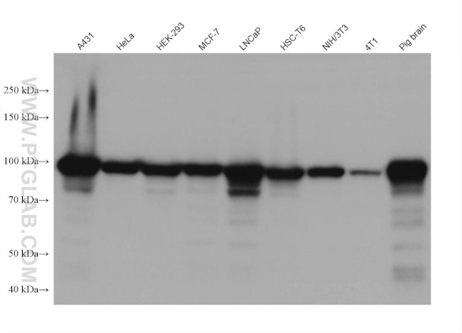 Beta Catenin Antibody in Western Blot (WB)