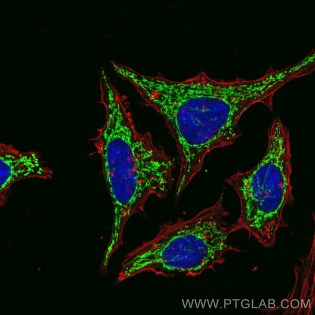 C1QBP Antibody in Immunocytochemistry (ICC/IF)