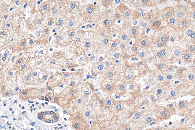 TOM20 Antibody in Immunohistochemistry (Paraffin) (IHC (P))