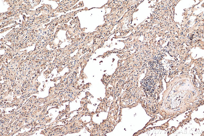 iNOS Antibody in Immunohistochemistry (Paraffin) (IHC (P))